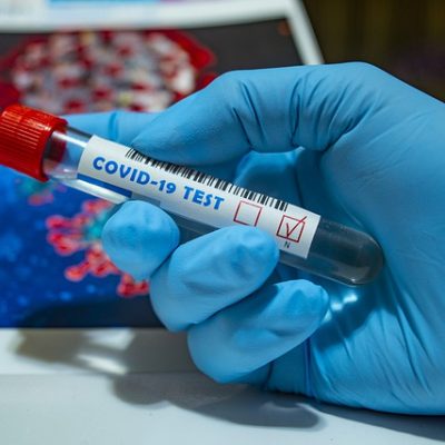 Tourists to Undergo Four COVID-19 Tests – Public Health Ministry
